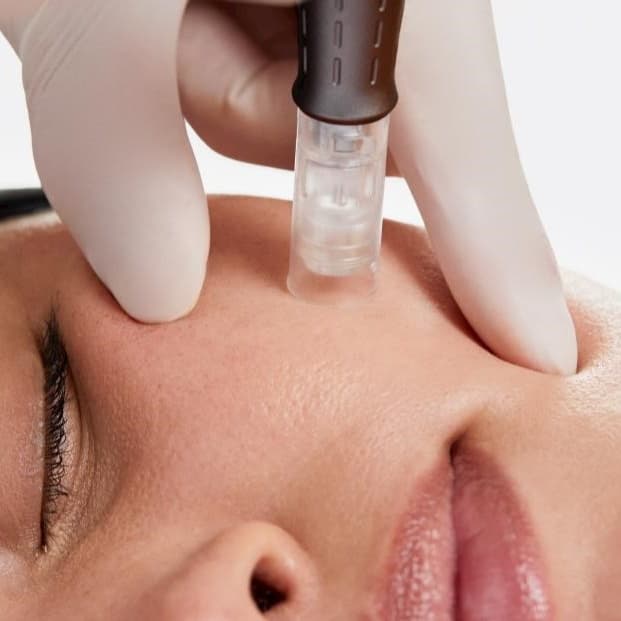 VIP skin transformation package at Jesse the Esthi in Rockford, IL